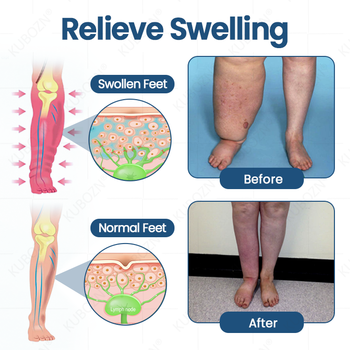 LOVILDS™ Lymphatic Drainage Roll-On Relief Cream image LOVILDS™ Lymphatic Drainage Roll-On Relief Cream